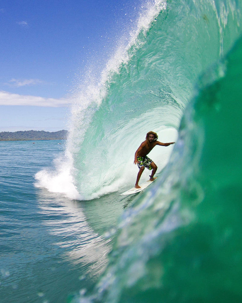 Surfing Costa Rica - Gilbert Brown es operado con éxito gracias al apoyo de la gente